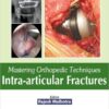 Mastering Orthopedic Techniques: Intra-articular Fractures 1st Edition