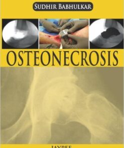 Osteonecrosis 1st Edition