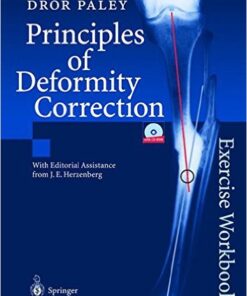 Principles of Deformity Correction