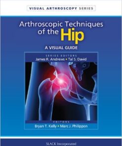 Arthroscopic Techniques of the Hip: A Visual Guide (Visual Arthroscopy) 1st Edition