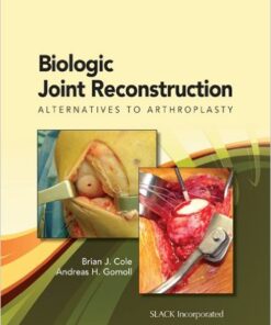 Biologic Joint Reconstruction: Alternatives to Joint Arthroplasty 1st Edition