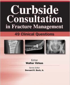 Curbside Consultation in Fracture Management: 49 Clinical Questions 1st Edition