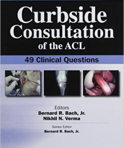 Curbside Consultation of the ACL: 49 Clinical Question 1st Edition