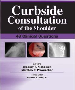 Curbside Consultation of the Shoulder: 49 Clinical Questions 1st Edition