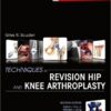 Techniques in Revision Hip and Knee Arthroplasty, 1e 1 Har/Psc Edition