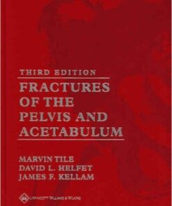 Fractures of the Pelvis and Acetabulum Third Edition