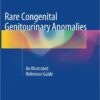 Rare Congenital Genitourinary Anomalies: An Illustrated Reference Guide