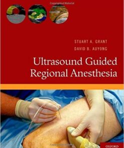 Ultrasound Guided Regional Anesthesia  Edition PDF