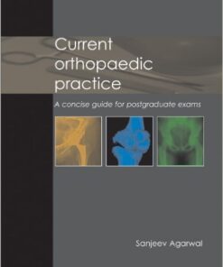 Current Orthopaedic Practice: A concise guide for postgraduate exams Kindle Edition