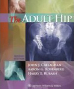 The Adult Hip (2 Volume)