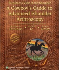 Burkhart's View of the Shoulder: A Cowboy's Guide to Advanced Shoulder Arthroscopy