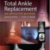 Total Ankle Replacement: An Operative Manual First Edition