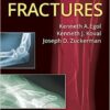 Handbook of Fractures Fifth Edition