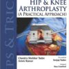 Tips and Tricks in Hip and Knee Arthroplasty: A Practical Approach 1 Edition