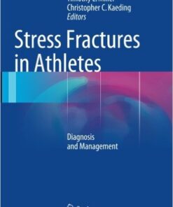 Stress Fractures in Athletes: Diagnosis and Management