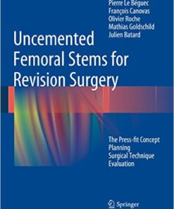 Uncemented Femoral Stems for Revision Surgery: The Press-fit Concept - Planning - Surgical Technique - Evaluation Kindle Edition