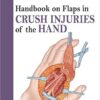 Handbook on Flaps in Degloving, Avulsion and Crush Injuries of the Hand 1st Edition