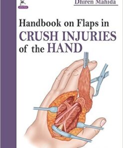 Handbook on Flaps in Degloving, Avulsion and Crush Injuries of the Hand 1st Edition