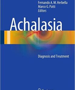 Achalasia: Diagnosis and Treatment 1st ed. 2016 Edition