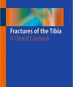 Fractures of the Tibia: A Clinical Casebook 1st ed. 2016 Edition