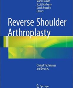 Reverse Shoulder Arthroplasty: Biomechanics, Clinical Techniques, and Current Technologies 1st ed. 2016 Edition