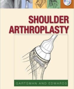 Shoulder Arthroplasty Kindle Edition