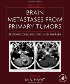 Brain Metastases from Primary Tumors. Epidemiology, Biology, and Therapy Volume 1