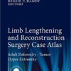 Limb Lengthening and Reconstruction Surgery Case Atlas: Adult Deformity • Tumor • Upper Extremity 1st ed. 2015 Edition