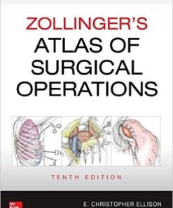 Zollinger's Atlas of Surgical Operations, Tenth Edition 10th Edition