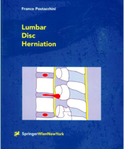 Lumbar Disc Herniation 1999th Edition