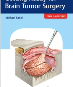 Getting Ready for Brain Tumor Surgery 1st Edition PDF ORIGINAL