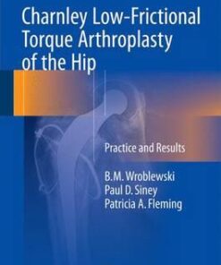 Charnley Low-Frictional Torque Arthroplasty of the Hip 2016 : Practice and Results