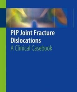 Pip Joint Fracture Dislocations 2016 : A Clinical Casebook