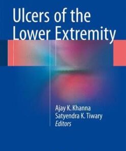 Ulcers of the Lower Extremity 2016