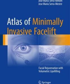 Atlas of Minimally Invasive Facelift 2016 : Facial Rejuvenation with Volumetric Lipofilling