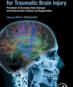 New Therapeutics for Traumatic Brain Injury : Prevention of Secondary Brain Damage and Enhancement of Repair and Regeneration