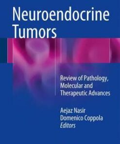 Neuroendocrine Tumors: Review of Pathology, Molecular and Therapeutic Advances 1st ed. 2016 Edition