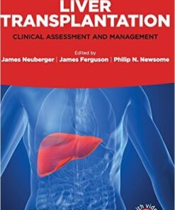 Liver Transplantation: Clinical Assessment and Management 1st Edition