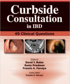 Curbside Consultation in IBD: 49 Clinical Questions 1st Edition