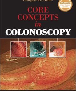 Core Concepts in Colonoscopy