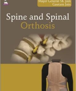 Spine and Spinal Orthosis 1st Edition