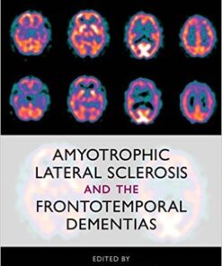 Amyotrophic Lateral Sclerosis and the Frontotemporal Dementias 1st Edition