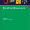 Renal Cell Carcinoma 1st Edition