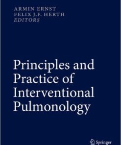 Principles and Practice of Interventional Pulmonology 2013th Edition