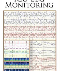 Handbook of ICU EEG Monitoring 1st Edition