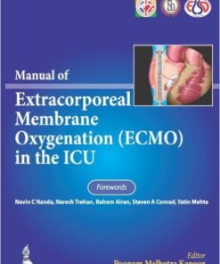 Manual of Extracorporeal Membrane Oxygenation (Ecmo) in the ICU 1st Edition