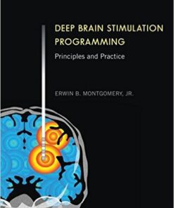 Deep Brain Stimulation Programming: Principles and Practice 1st Edition