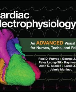 Cardiac Electrophysiology 2: An Advanced Visual Guide for Nurses, Techs, and Fellows