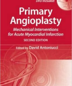 Primary Angioplasty: Mechanical Interventions for Acute Myocardial Infarction