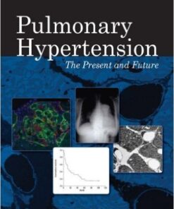 Pulmonary Hypertension: The Present and Future